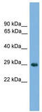 NK1 Homeobox 2 antibody, TA341812, Origene, Western Blot image 