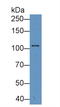 Dihydropyrimidine dehydrogenase [NADP+] antibody, LS-C372861, Lifespan Biosciences, Western Blot image 