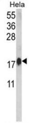 Calmodulin antibody, AP17918PU-N, Origene, Western Blot image 