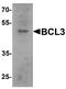 BCL3 Transcription Coactivator antibody, A02773, Boster Biological Technology, Western Blot image 