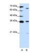 PR/SET Domain 13 antibody, NBP1-80361, Novus Biologicals, Western Blot image 