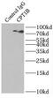 Carnitine Palmitoyltransferase 1B antibody, FNab01944, FineTest, Immunoprecipitation image 