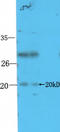 Stathmin 3 antibody, orb101319, Biorbyt, Western Blot image 