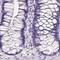 Pancreatic triacylglycerol lipase antibody, PA5-64027, Invitrogen Antibodies, Immunohistochemistry paraffin image 