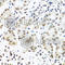 Insulin Like Growth Factor 2 MRNA Binding Protein 1 antibody, A1517, ABclonal Technology, Immunohistochemistry paraffin image 