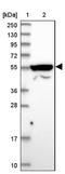 Ankyrin Repeat Domain 34B antibody, NBP1-90487, Novus Biologicals, Western Blot image 