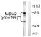 Hdm2 antibody, LS-C199240, Lifespan Biosciences, Western Blot image 