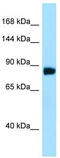 DNA Damage Induced Apoptosis Suppressor antibody, TA343274, Origene, Western Blot image 