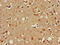 Homeobox protein OTX1 antibody, LS-C678910, Lifespan Biosciences, Immunohistochemistry paraffin image 
