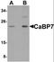 Calcium Binding Protein 7 antibody, orb94561, Biorbyt, Western Blot image 