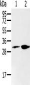 Renalase, FAD Dependent Amine Oxidase antibody, TA351592, Origene, Western Blot image 