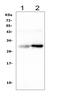 Amyloid P Component, Serum antibody, PB9021, Boster Biological Technology, Western Blot image 