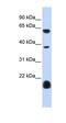 5-Hydroxytryptamine Receptor 3E antibody, orb324611, Biorbyt, Western Blot image 