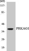 Protein Kinase AMP-Activated Non-Catalytic Subunit Gamma 1 antibody, LS-C200525, Lifespan Biosciences, Western Blot image 