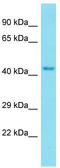 Keratinocyte Differentiation Factor 1 antibody, TA334110, Origene, Western Blot image 