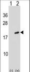 ADP Ribosylation Factor Like GTPase 2 antibody, LS-C156491, Lifespan Biosciences, Western Blot image 