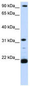 SNF8 Subunit Of ESCRT-II antibody, TA344526, Origene, Western Blot image 