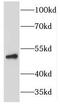 Histidyl-TRNA Synthetase antibody, FNab03758, FineTest, Western Blot image 