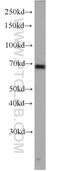 G Protein Signaling Modulator 2 antibody, 11608-2-AP, Proteintech Group, Western Blot image 