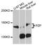 Pregnancy zone protein antibody, MBS129131, MyBioSource, Western Blot image 