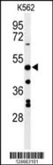 Rh Family B Glycoprotein (Gene/Pseudogene) antibody, 64-221, ProSci, Western Blot image 