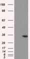 Alcohol dehydrogenase [NADP+] antibody, GTX84913, GeneTex, Western Blot image 