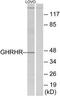 Growth Hormone Releasing Hormone Receptor antibody, TA311715, Origene, Western Blot image 