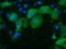 Protein Kinase D2 antibody, TA501672, Origene, Immunofluorescence image 