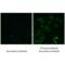 Estrogen Receptor 2 antibody, ALX-210-132-C100, Enzo Life Sciences, Immunofluorescence image 