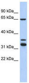 S100P Binding Protein antibody, TA336076, Origene, Western Blot image 