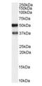 Protein kinase C and casein kinase substrate in neurons protein 1 antibody, orb18842, Biorbyt, Western Blot image 