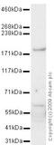 Histone-lysine N-methyltransferase, H3 lysine-79 specific antibody, ab64077, Abcam, Western Blot image 