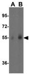Makorin Ring Finger Protein 3 antibody, GTX32153, GeneTex, Western Blot image 