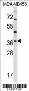 Ring Finger Protein 144A antibody, 57-706, ProSci, Western Blot image 
