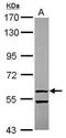 2'-5'-Oligoadenylate Synthetase Like antibody, GTX118999, GeneTex, Western Blot image 