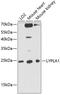 Lysophospholipase 1 antibody, GTX66442, GeneTex, Western Blot image 