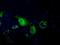 Pantothenate Kinase 2 antibody, MA5-25152, Invitrogen Antibodies, Immunocytochemistry image 