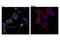Proprotein Convertase Subtilisin/Kexin Type 2 antibody, 14013T, Cell Signaling Technology, Immunocytochemistry image 