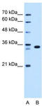Arginine-Fifty Homeobox antibody, TA342403, Origene, Western Blot image 