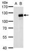 Myocardin Related Transcription Factor A antibody, GTX129371, GeneTex, Western Blot image 
