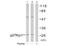 Cyclin Dependent Kinase Inhibitor 1B antibody, AP02674PU-S, Origene, Western Blot image 
