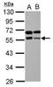 Zinc Finger And BTB Domain Containing 9 antibody, PA5-30915, Invitrogen Antibodies, Western Blot image 