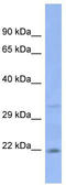 JAM-2 antibody, TA338012, Origene, Western Blot image 