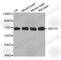 ATP Binding Cassette Subfamily G Member 2 (Junior Blood Group) antibody, A6159, ABclonal Technology, Western Blot image 