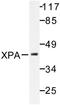 XPA, DNA Damage Recognition And Repair Factor antibody, LS-C176369, Lifespan Biosciences, Western Blot image 