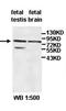 ADAM Metallopeptidase Domain 18 antibody, orb77716, Biorbyt, Western Blot image 