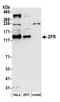 Zinc finger RNA-binding protein antibody, A304-868A, Bethyl Labs, Western Blot image 