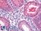 DnaJ homolog subfamily C member 10 antibody, LS-B11250, Lifespan Biosciences, Immunohistochemistry paraffin image 