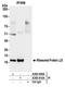 Ribosomal Protein L17 antibody, A305-008A, Bethyl Labs, Immunoprecipitation image 