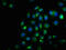 Serine/threonine-protein kinase/endoribonuclease IRE1 antibody, CSB-RA007795A724phHU, Cusabio, Immunofluorescence image 